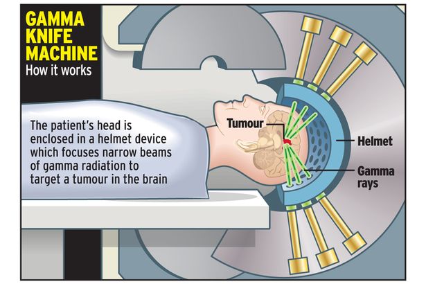 Gamma Knife For AVM Or Brain Tumor Treatment In India By GetWellGo Gamma Knife For AVM Or Brain Tumor Treatment In India By GetWellGo